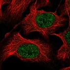 Immunofluorescent staining of human cell line U-2 OS shows localization to nucleoplasm.