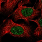 Immunofluorescent staining of human cell line U-2 OS shows localization to nucleoplasm.