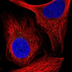 Immunofluorescent staining of human cell line U-2 OS shows localization to vesicles.