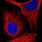 Immunofluorescent staining of human cell line U-2 OS shows localization to vesicles.
