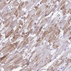 Anti-ST8SIA2 Antibody