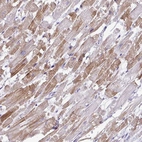 Anti-ST8SIA2 Antibody