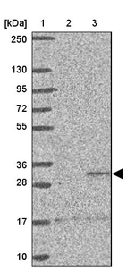 Lane 1: Marker [kDa] 250, 130, 95, 72, 55, 36, 28, 17, 10_br/_Lane 2: Human cell line RT-4_br/_Lane 3: Human cell line U-251MG sp