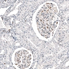 Immunohistochemical staining of human kidney shows moderate to strong nuclear positivity in cells in glomeruli.