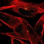 Immunofluorescent staining of human cell line RH-30 shows localization to microtubule organizing center.