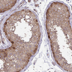 Anti-IST1 Antibody