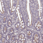 Immunohistochemical staining of human duodenum moderate granular cytoplasmic positivity in glandular cells.