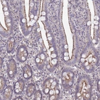 Immunohistochemical staining of human duodenum moderate granular cytoplasmic positivity in glandular cells.