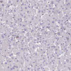 Immunohistochemical staining of human liver shows no positivity in hepatocytes as expected.