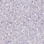 Immunohistochemical staining of human liver shows no positivity in hepatocytes as expected.