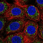 Immunofluorescent staining of human cell line MCF7 shows localization to vesicles.