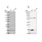 Western blot analysis using Anti-MRPS16 antibody HPA054538 (A) shows similar pattern to independent antibody HPA050081 (B).