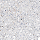 Immunohistochemical staining of human liver shows no positivity in hepatocytes as expected.