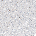 Anti-TFE3 Antibody