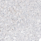 Immunohistochemical staining of human liver shows no positivity in hepatocytes as expected.