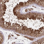 Anti-UBE2M Antibody