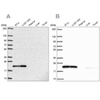 Western blot analysis using Anti-UBE2M antibody HPA054551 (A) shows similar pattern to independent antibody HPA057800 (B).