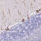 Anti-PRKCG Antibody