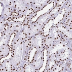 Immunohistochemical staining of human kidney shows strong nuclear positivity in cells in tubules.