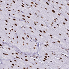 Immunohistochemical staining of human heart muscle shows strong nuclear positivity in cardiomyocytes.