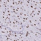 Immunohistochemical staining of human heart muscle shows strong nuclear positivity in cardiomyocytes.