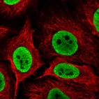 Immunofluorescent staining of human cell line HeLa shows localization to nucleoplasm.