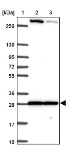 Lane 1: Marker [kDa] 250, 130, 95, 72, 55, 36, 28, 17, 10_br/_Lane 2: Human cell line RT-4_br/_Lane 3: Human cell line U-251 MG