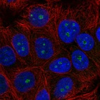 Anti-TRIM52 Antibody