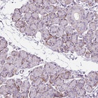 Anti-ZNF197 Antibody