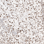 Anti-TFE3 Antibody