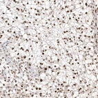Anti-TFE3 Antibody
