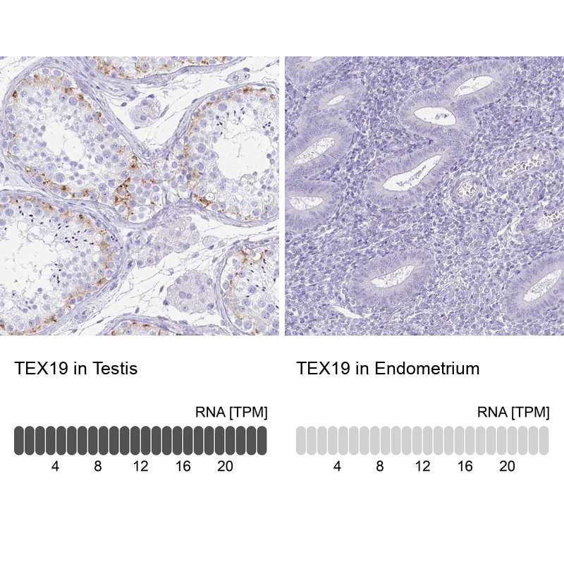 Anti-TEX19 Antibody