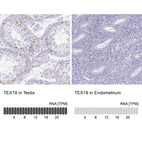 Anti-TEX19 Antibody
