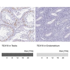 Anti-TEX19 Antibody
