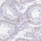 Immunohistochemical staining of human testis shows high expression.
