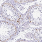 Immunohistochemical staining of human testis shows high expression.
