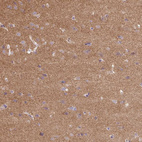 Anti-FLRT1 Antibody