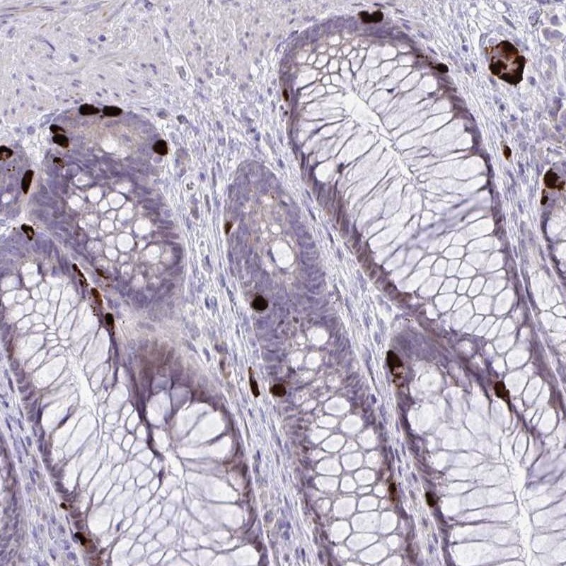 Anti-KRT222 Antibody