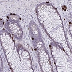 Anti-KRT222 Antibody