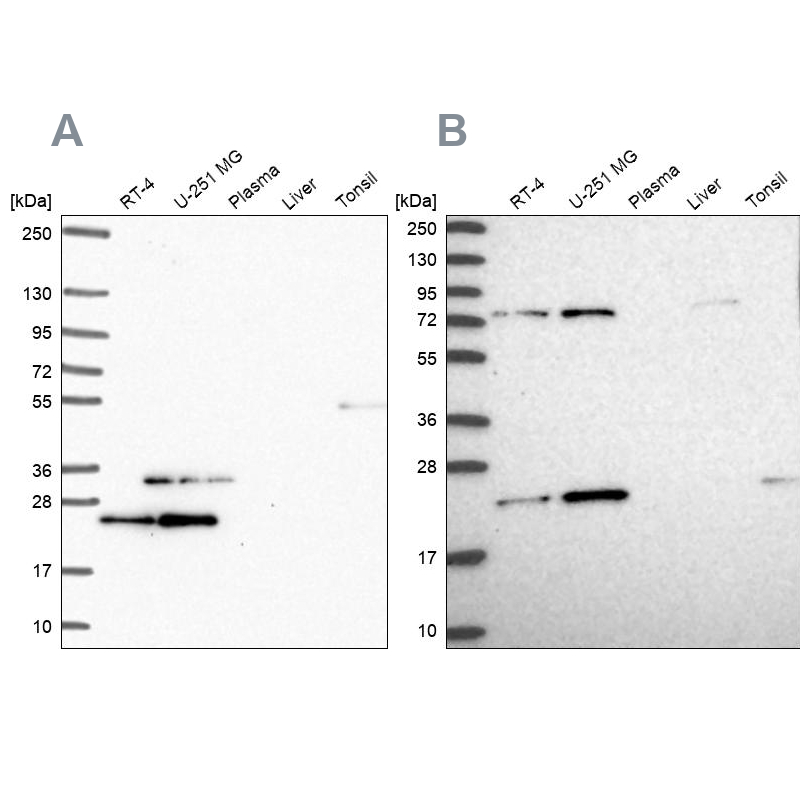 Anti-EIF3K Antibody