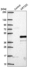 Western blot analysis in control (vector only transfected HEK293T lysate) and KRT222 over-expression lysate (Co-expressed with a C-terminal myc-DDK tag (~3.1 kDa) in mammalian HEK293T cells, LY407599).