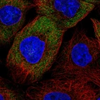Immunofluorescent staining of human cell line A-431 shows localization to cytosol.