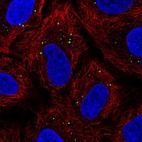 Immunofluorescent staining of human cell line A549 shows localization to vesicles.