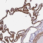 Anti-IGSF23 Antibody
