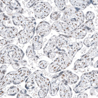 Anti-TFE3 Antibody