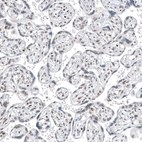 Immunohistochemical staining of human placenta shows moderate nuclear positivity in trophoblastic cells.