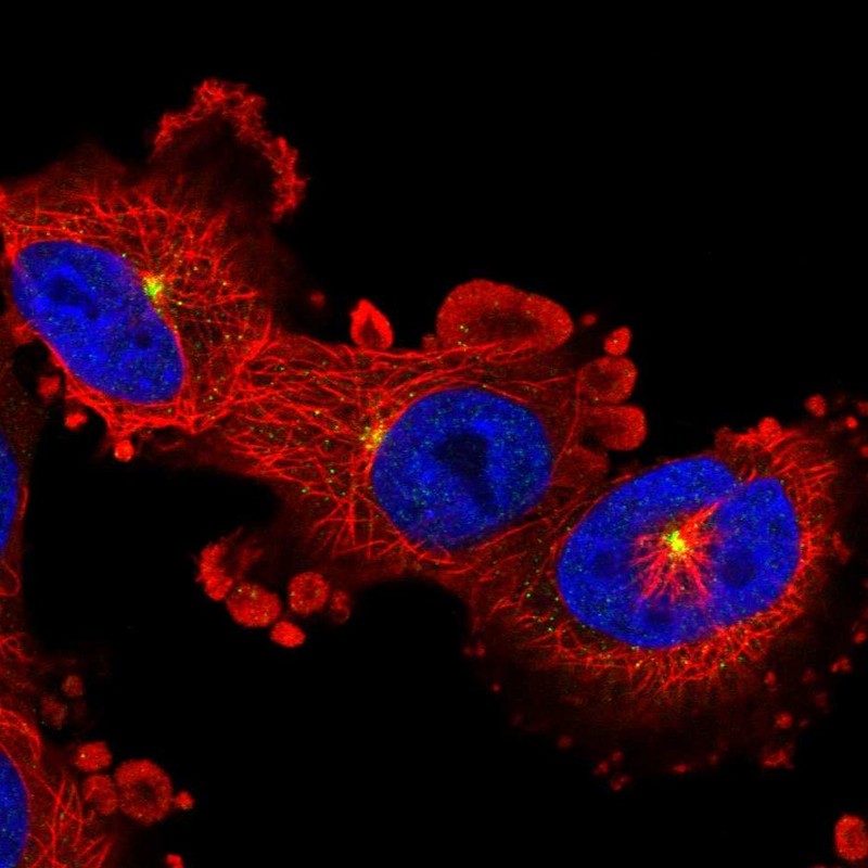 Anti-ADGRB2 Antibody