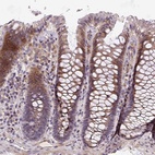 Anti-RNF170 Antibody