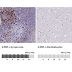 Anti-IL2RA Antibody