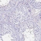 Immunohistochemical staining of human testis shows no positivity in cells in seminiferous ducts as expected.